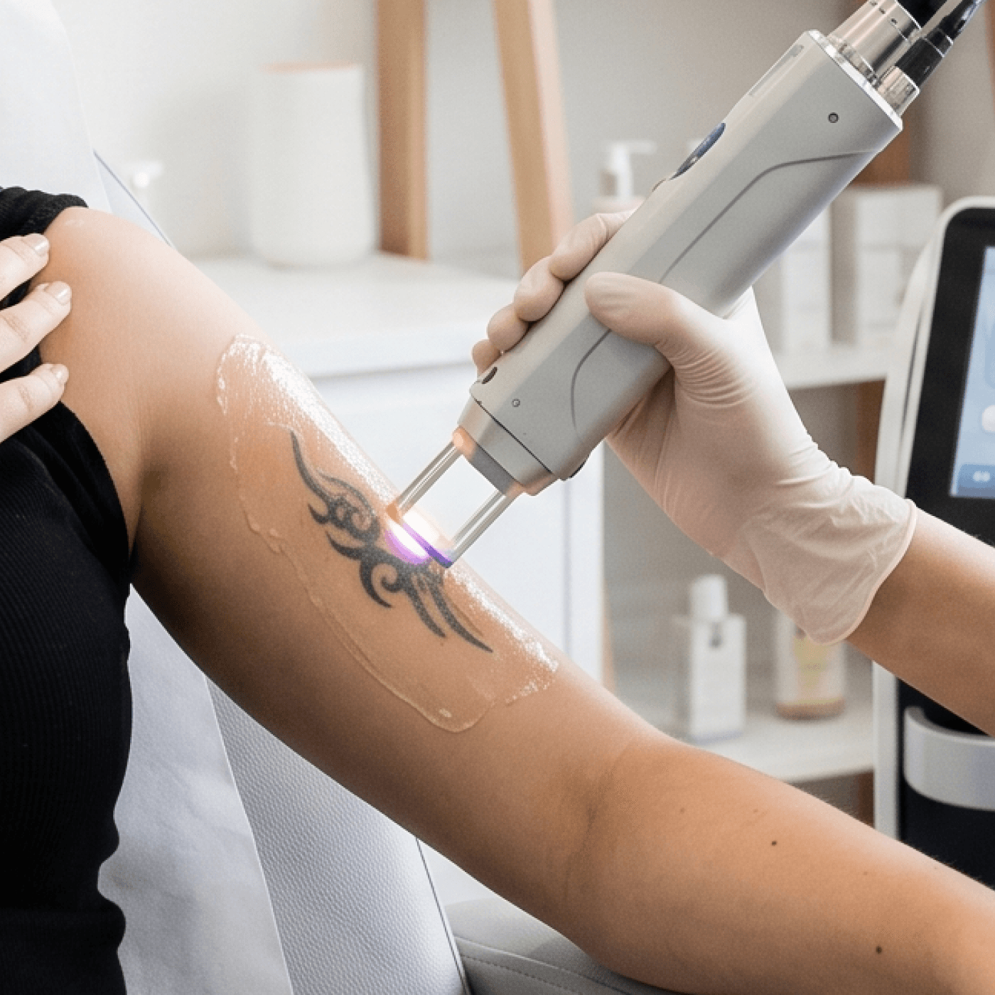 Laser removal